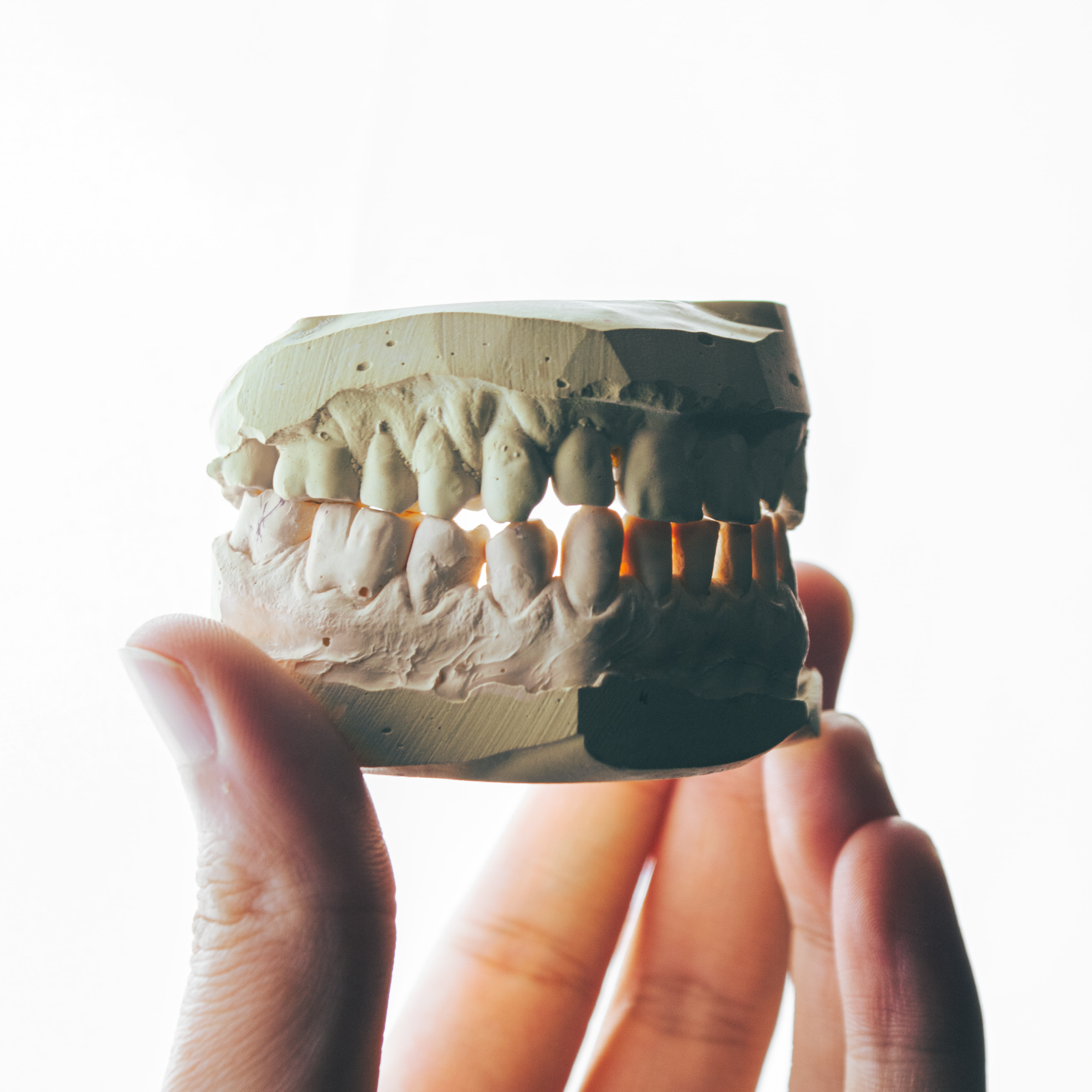 Hand holding a plaster mold of teeth represents our integrated marketing work for Gilbert Orthodontics.